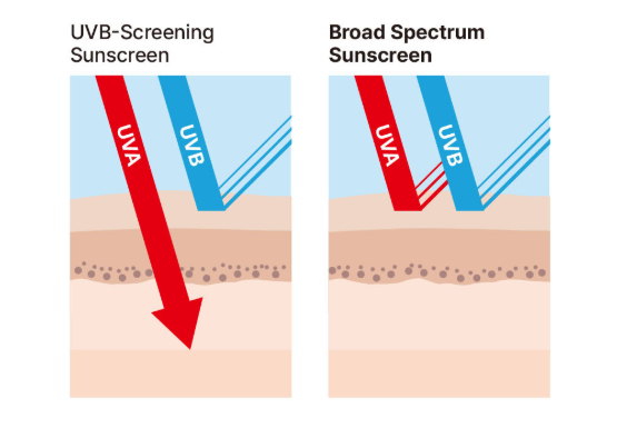 UVB-Screening vs Broad Spectrum 비교 이미지
